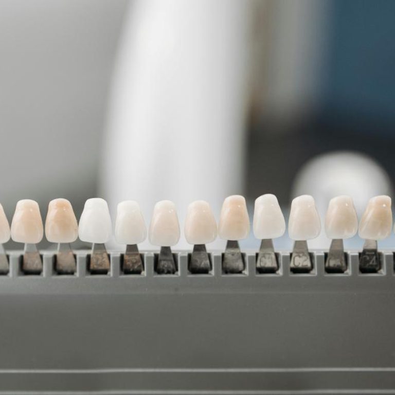 porcelain-teeth-4845a9c89f0c4e7f9f3b5195cb819af2